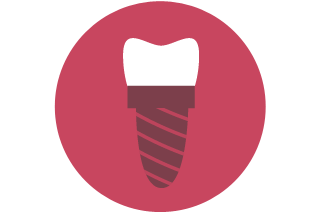 implant